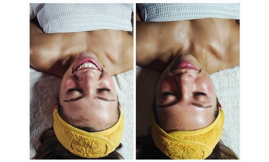 Image 3: Microdermabrasion or Microchanneling Facial for Rejuvenated Skin