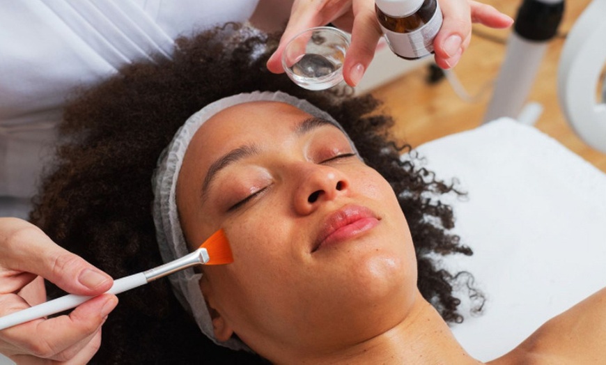 Image 1: Up to 48% Off on Facial - Chemical Peel at Regains Beauty & Aesthetics