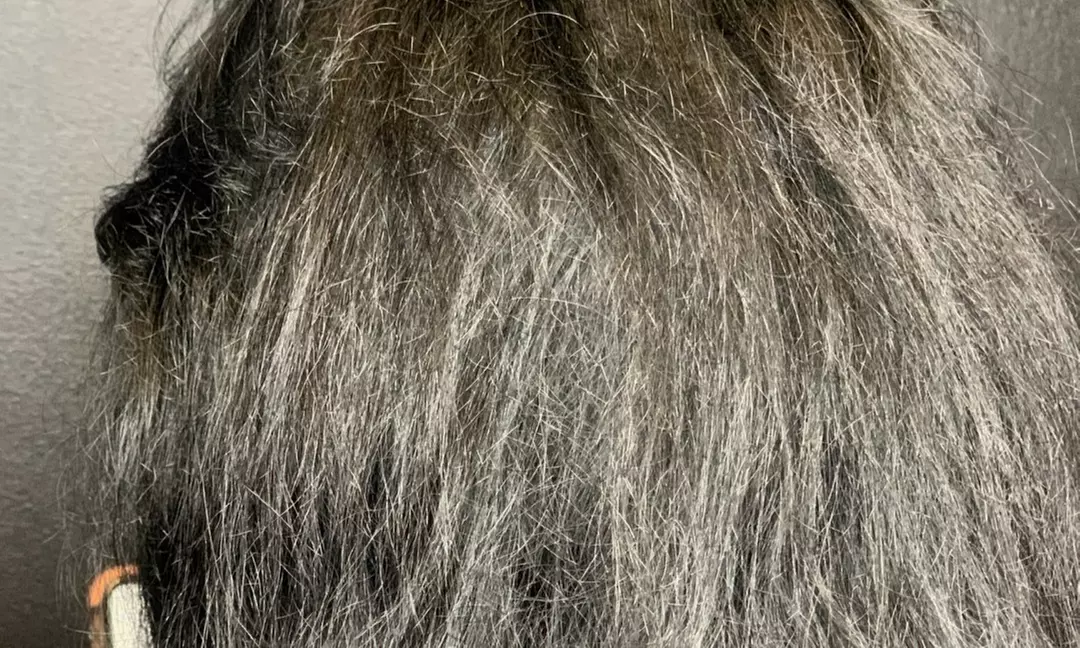 Up to 46% Off on Hair Restoration - Implants at Bravado Scalp MicroPigmentation - Second Medium