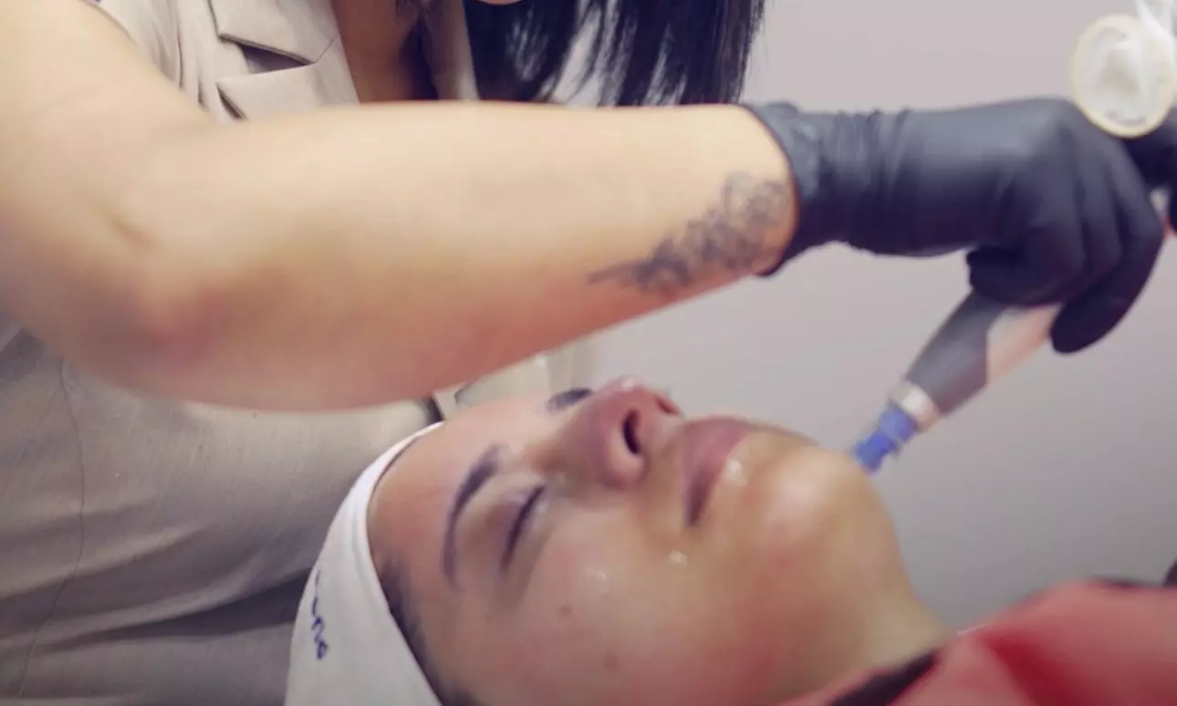 Enjoy Skin Needling With LED Therapy, Face Mask, And Consultation