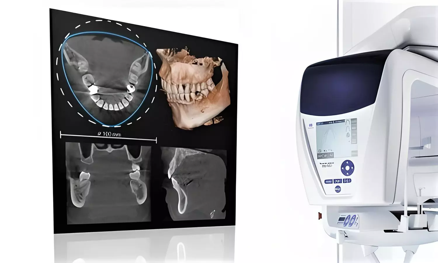 Tomografía axial computarizada (TAC) de 1 o 2 arcadas en Clínica Citadental Orense - Primary Image