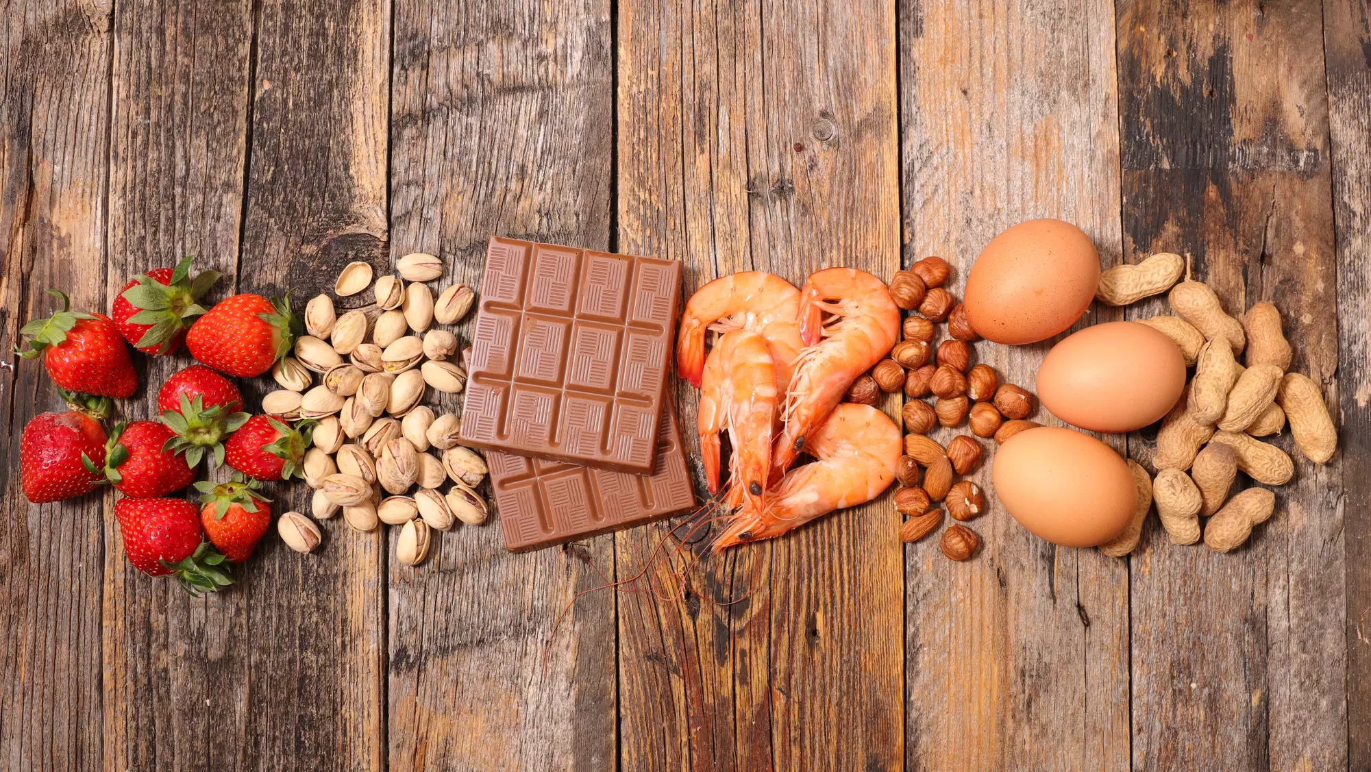 Basic Food Sensitivity or Metabolism Panel Tests from Lab Testing API (Up to 48% Off) - Primary Image