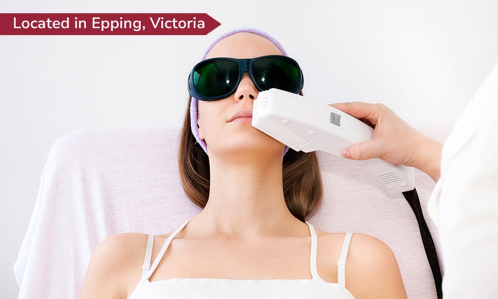 IPL Photo Rejuvenation on Full Face, Add on Neck at My Beauty Angels