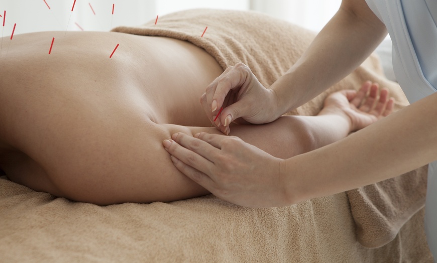 Image 5: Up to 42% Off on Massage - Specific Body Part (Hand, Neck, Head) at Active care clinic