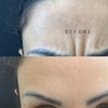 Image 1: 20 or 40 Units of Xeomin for a Youthful Look
