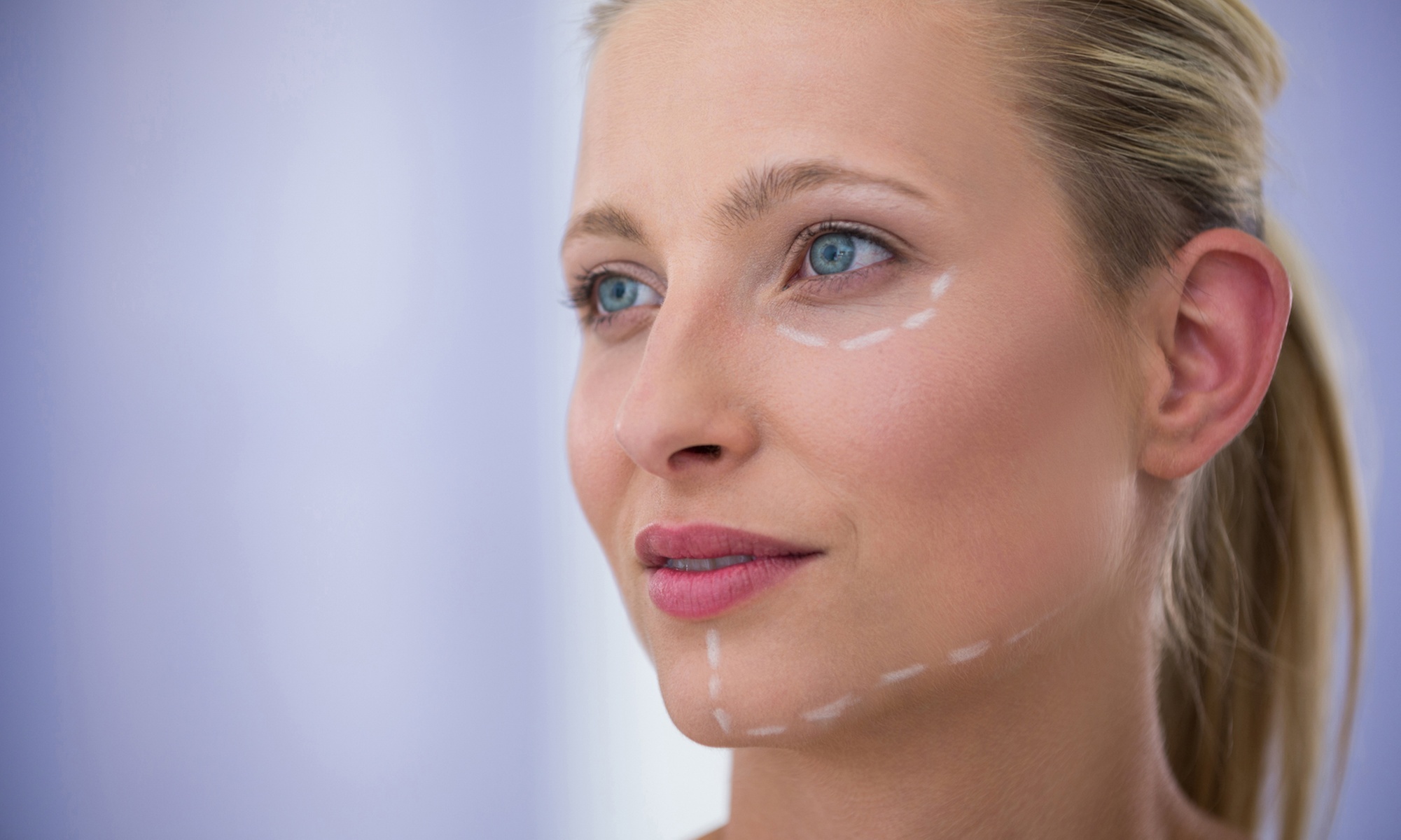 Wertgutschein für Vampir-Lifting