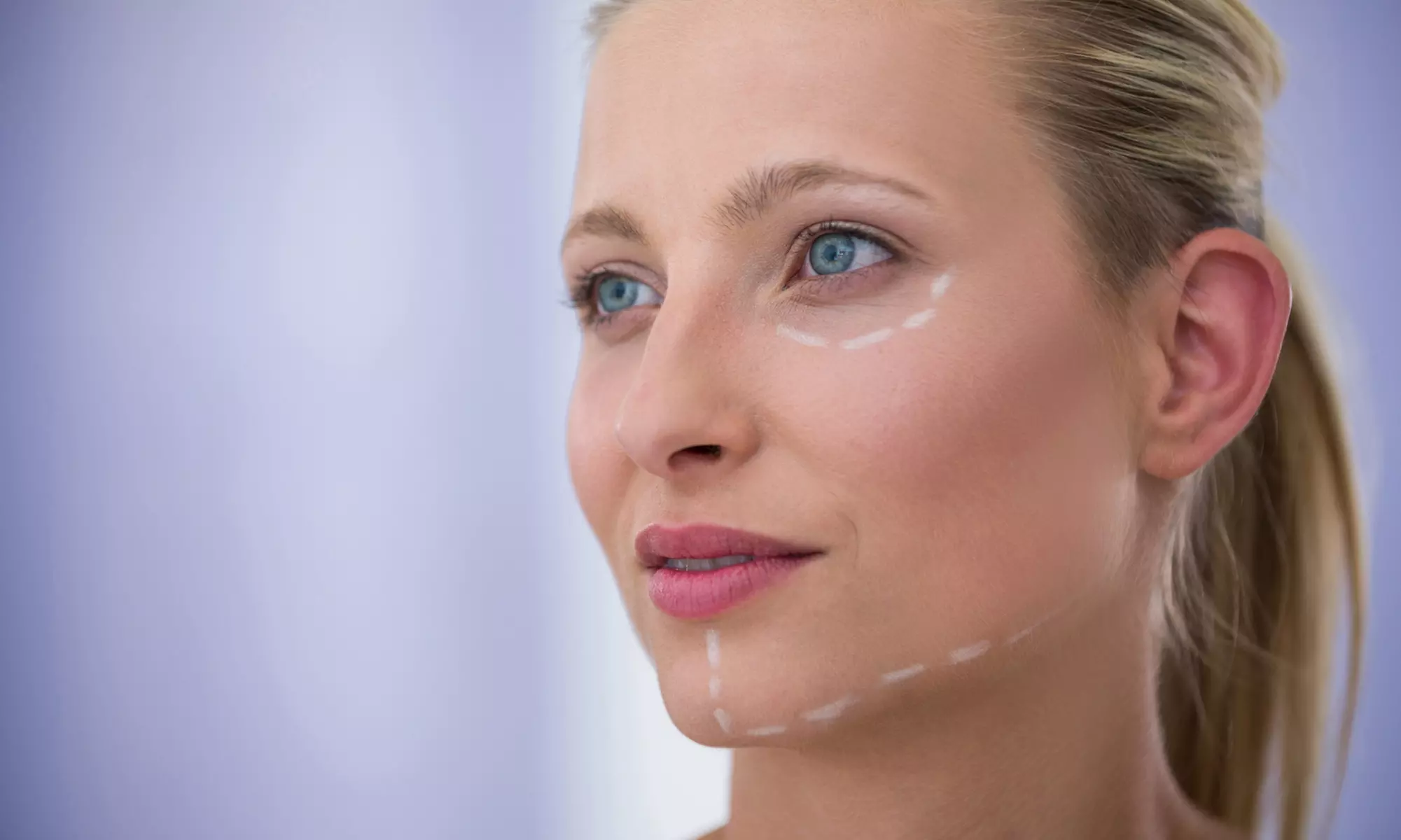 Wertgutschein über bis zu 219€ für ein Vampir-Lifting an einer Zone in der SB clinic - Primary Image