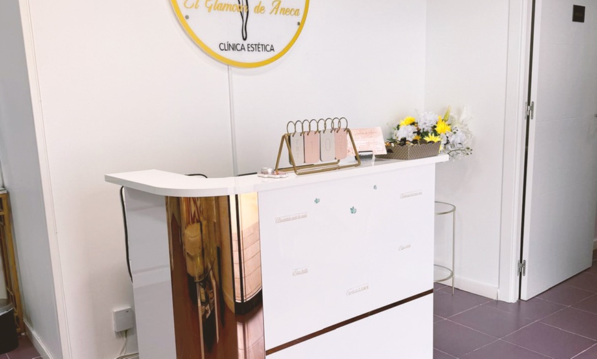 Image 5: Tratamiento de rejuvenecimiento facial con 10 o 20 hilos tensores PDO