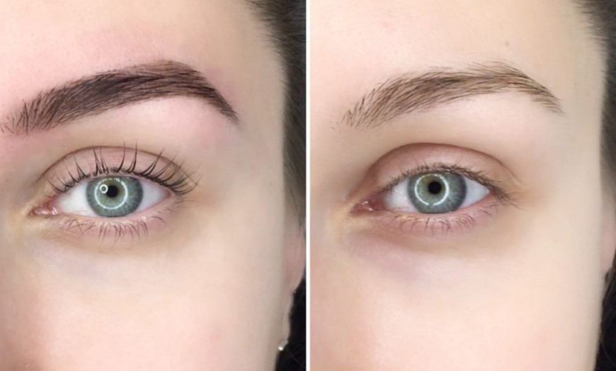 Image 1: PicoSure Eyebrow Tattoo Removal Treatment - Tulip Beauty Lash And Brow