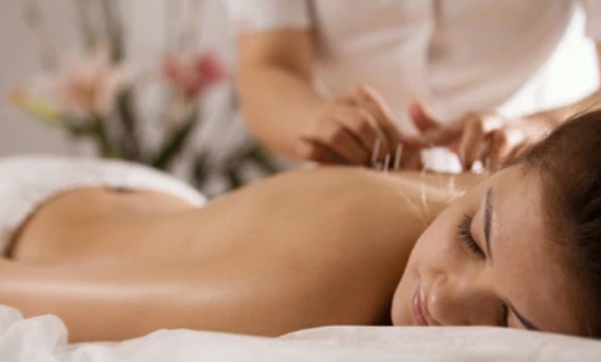 Image 4: 60 Minute Sessions of Hot Stone, Acupuncture or Cupping
