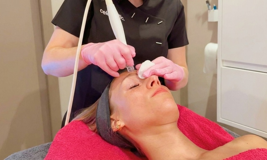 Image 5: Gezichtsbehandeling of huidverbetering naar keuze