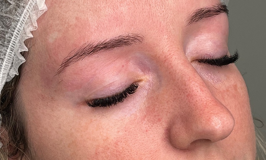 Image 14: Microblading Session with Touch Up at Elizabeth Beauty and Laser