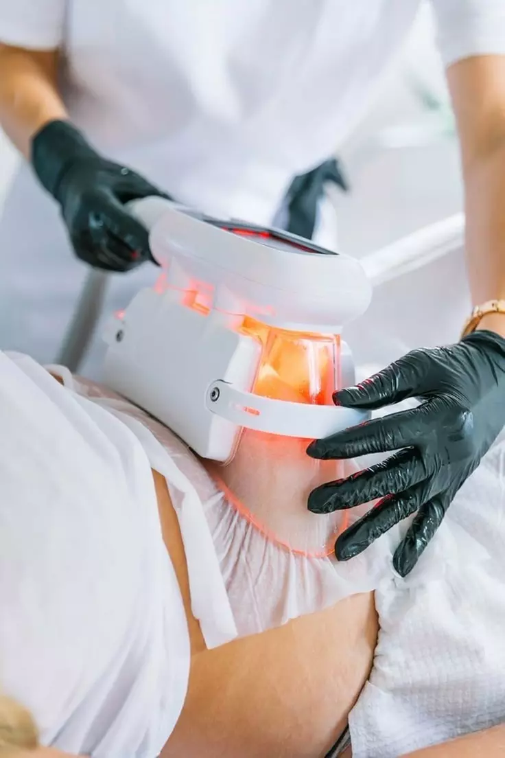 Shape Up for the Season!  Cryo 3D Lipo Fat Freezing for 2 Areas