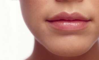 image for Dermal Filler for Lips