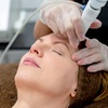 Image 1: Wildflower Spa: Before & After Laser Genesis Skin Rejuvenation Results