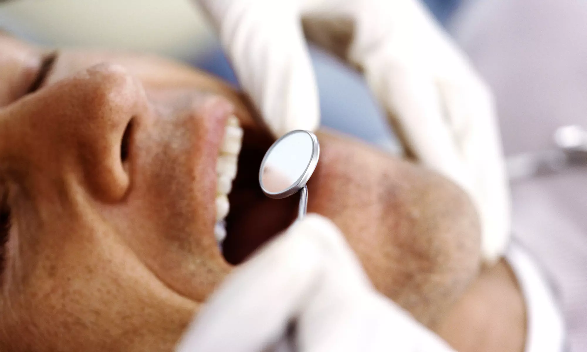 $49 for a Dental Package with Exam, Cleaning, and X-rays at Vanguard Dental in Mineola ($450 Value) - Primary Image