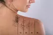 Eliminación de tatuajes con láser en Carmen Mulet Peluquería y Estética - Image 3