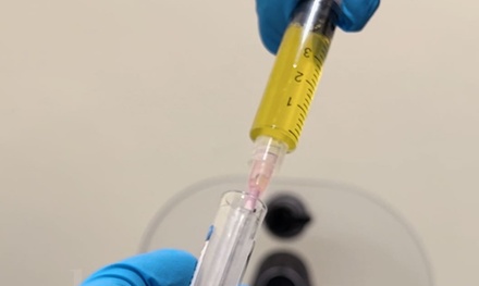 One Platelet-Rich Plasma (PRP) For Under-eyes - One Beauty Aesthetics - Irvine