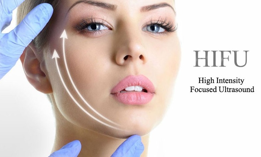 Image 2: HIFU Face Treatment