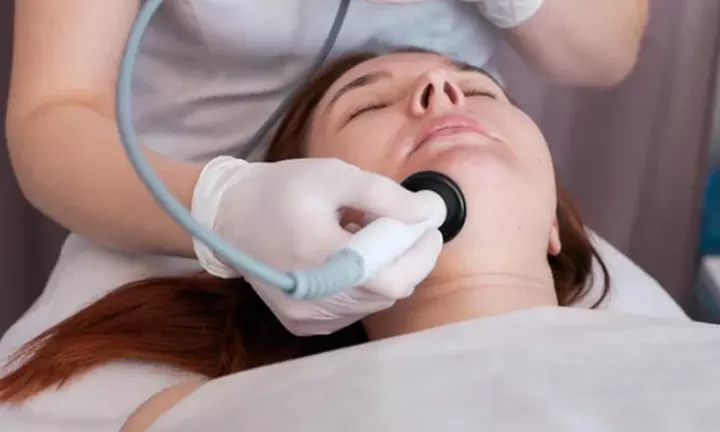 Radiofrecuencia facial: cuidado sin prisas, resultados visibles