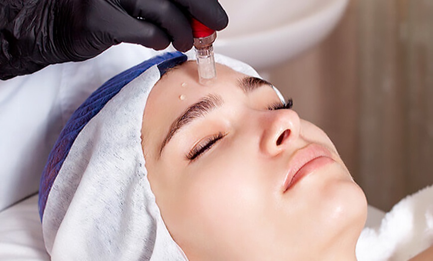 Image 7: 1 o 3 sesiones de dermapen facial con vitaminas o exosomas