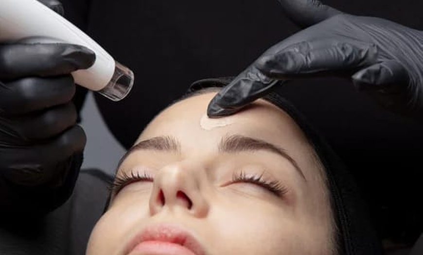 Image 5: 1 oder 2 BB-Glow- oder Microneedling-Behandlungen 