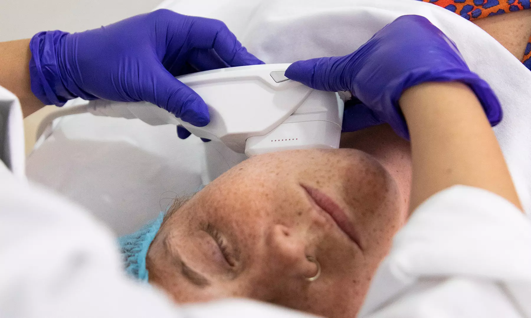 3 o 6 sesiones de tratamiento HIFU en The Look Madrid