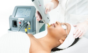 Six Sessions of Laser Hair Removal Tailored with Expert Care