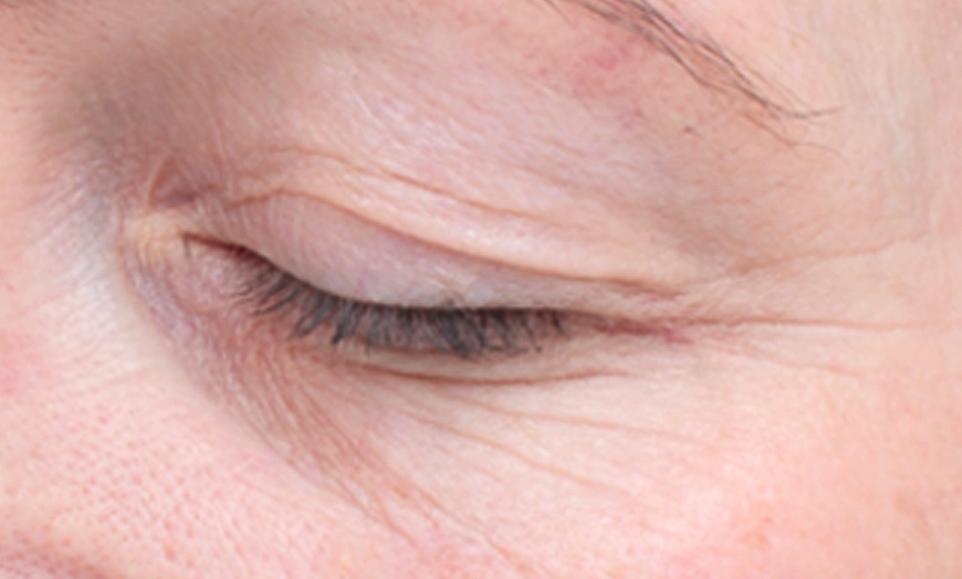 Image 4: CACI Facial Treatment