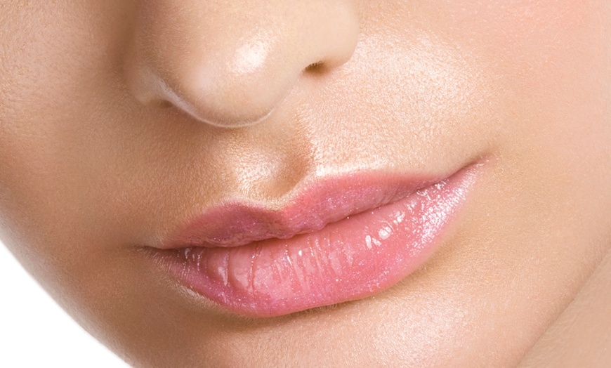 Image 1: Get Gorgeous Lips with Lip Blush Treatment