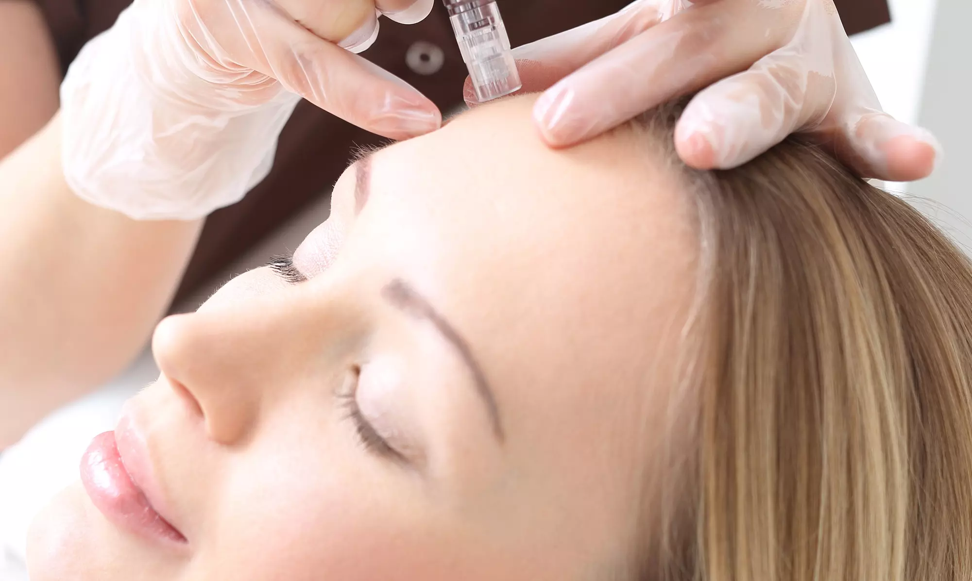 One or Two Microneedlings w/ Collagen Induction Therapy and Peptide Mask at Beaut BlissHydration (Up to 52% Off) - Primary Image