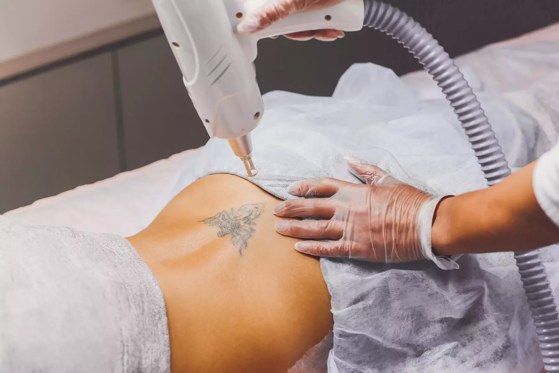 Remove that Unwanted Ink! 1, 4, or 7 Laser Tattoo Removal Sessions