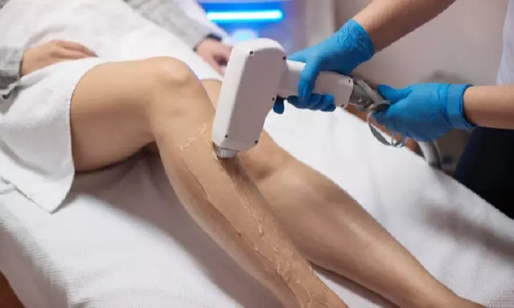 Sesiones de depilación láser en Salin Estética y Bienestar