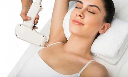 6x Laser Hair Removal Sessions for One Small Area *w Alexandrite + Nd:YAG Dual Laser System - Aurora Advanced Aesthetics