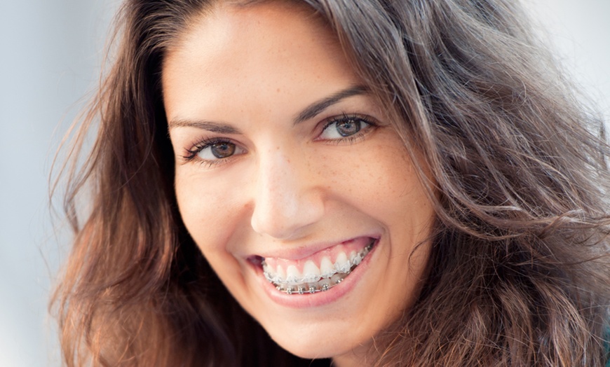 Image 1: Get a Confident Smile with 5-Star Rated Clear Braces in West London!