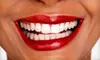 $179 for a Dental Consultation, Exam, X-Rays, Cleaning, and Zoom! Teeth-Whitening from Kenneth E. Stoner, DDS, and Associates (Up to $799 Value)