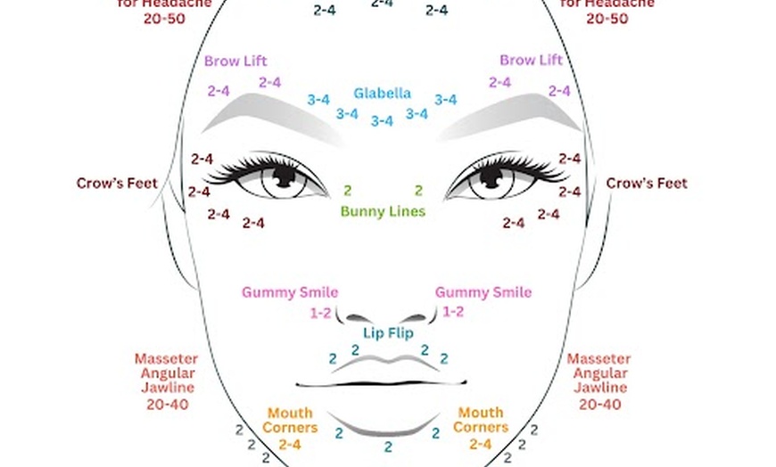Image 2: Smooth Away Wrinkles with 40 or 60 Units of Botox