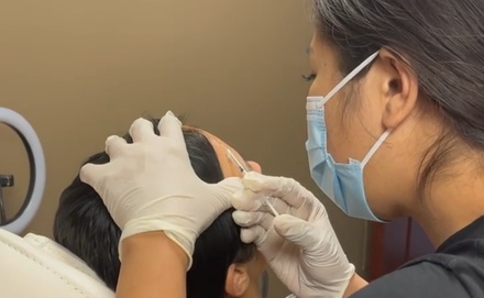 20 Units of Botox - Dr Tam Med Spa Clinic