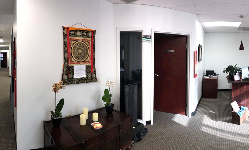 Image 2: Custom Acupuncture & Holistic Health Consultation: 1 or 3 Session