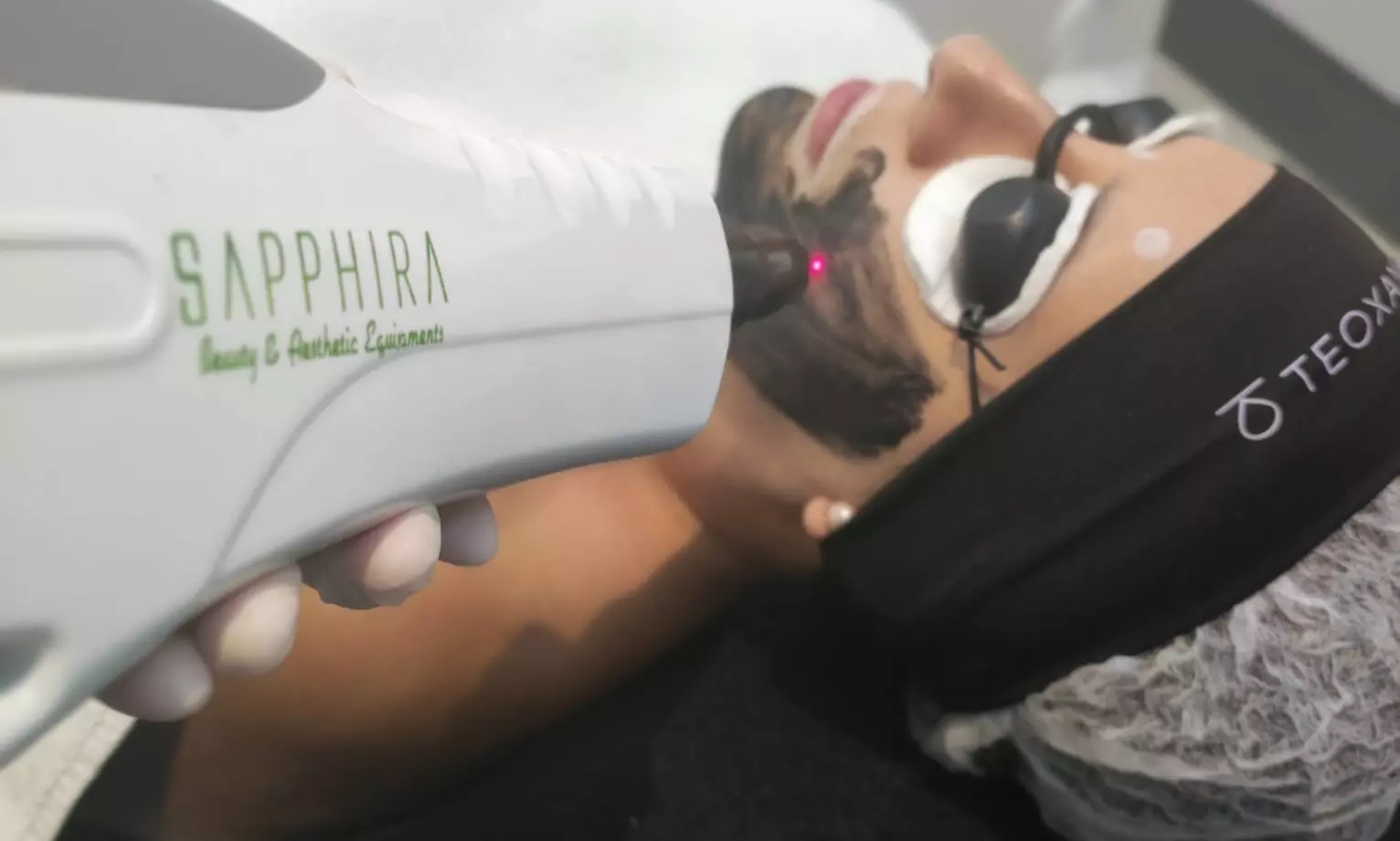 Tratamiento facial con láser en Sapphira Prive Madrid centro