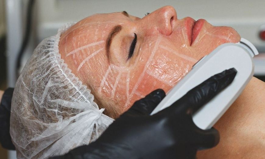Image 1: Boost Natural Appearance w/ Restylane, Jeaveau, or Revenesse Versa