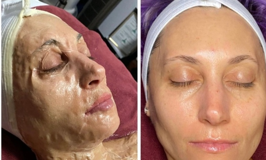 Image 1: Peel Away the Past: Your Fresh Face Starts Here at The Skin Sanctuary 