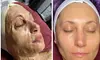Peel Away the Past – Your Fresh Face Starts Here at The Skin Sanctuary