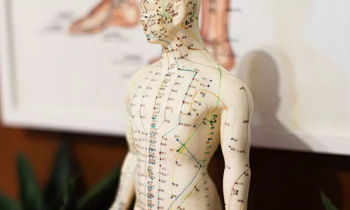 Fadenlifting nach Wahl