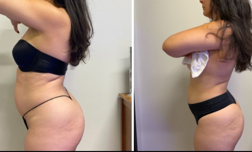 Image 4: Sculpt, Tone, And Glow with 30,45,60,or 90-Min Sculpting Sessions 