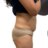 Image 2: Choose from 60 Minute Ultrasonic Cavitation or Skin Tightening