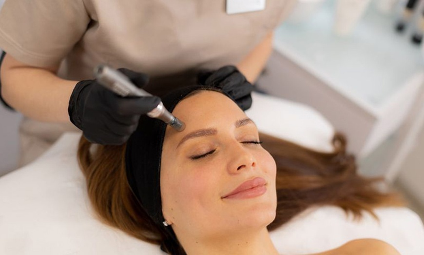 Image 1: Up to 55% Off on Micro-Needling at Nova Luna Wellness
