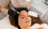 Up to 50% Off on Micro-Needling at Nova Luna Wellness