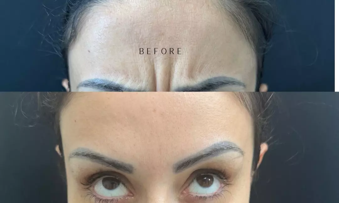 Snag a $100 or $200 Gift Card for Cosmetic Services