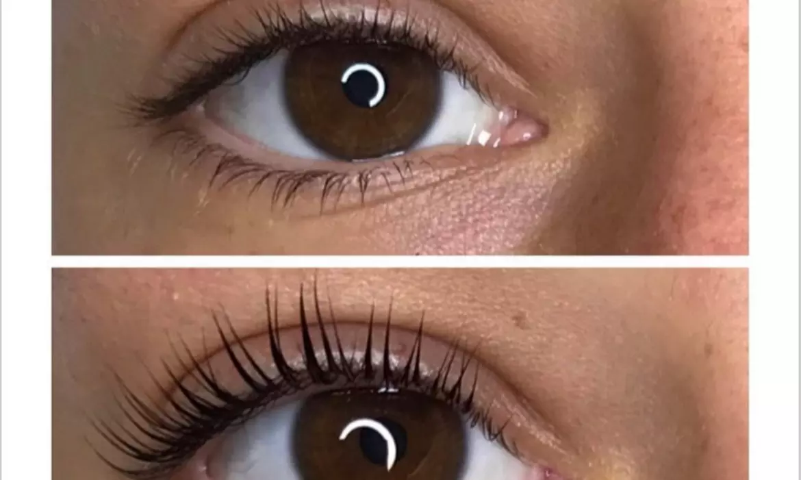 Up to 41% Off on Eyebrow Tinting at SKINN - Second Medium